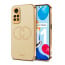 Vaku ® Xiaomi Redmi Note 11 Skylar Leather Pattern Gold Electroplated Soft TPU Back Cover
