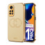 Vaku ® Xiaomi Redmi Note 11 Pro Skylar Leather Pattern Gold Electroplated Soft TPU Back Cover